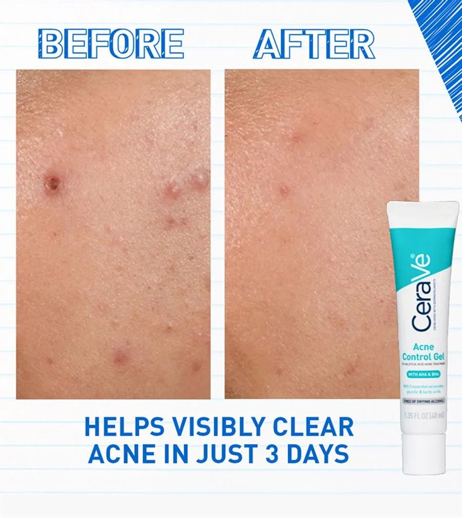 CeraVe Acne Control Gel 40ml - photo 4