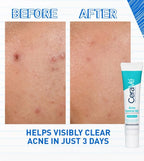CeraVe Acne Control Gel 40ml - photo 4
