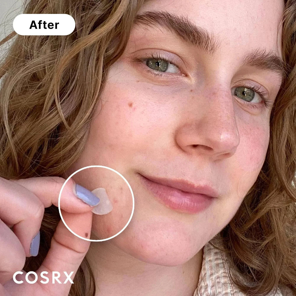 COSRX Acne Pimple Master Patch 24 Patches - photo 10