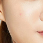 COSRX Acne Pimple Master Patch 24 Patches - photo 3