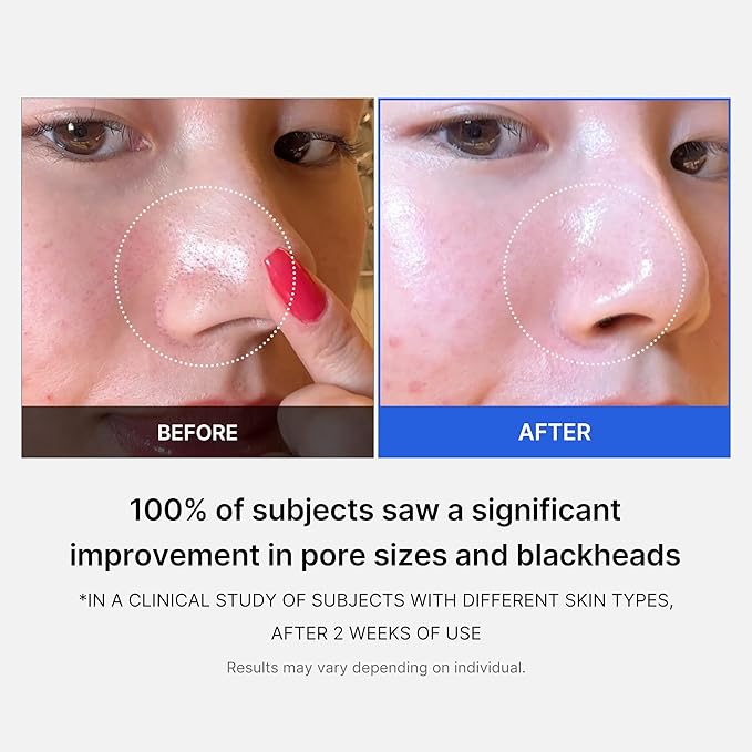 Medicube Zero Pore Pad 2.0 (70pcs) - photo 5