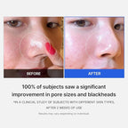 Medicube Zero Pore Pad 2.0 (70pcs) - photo 5