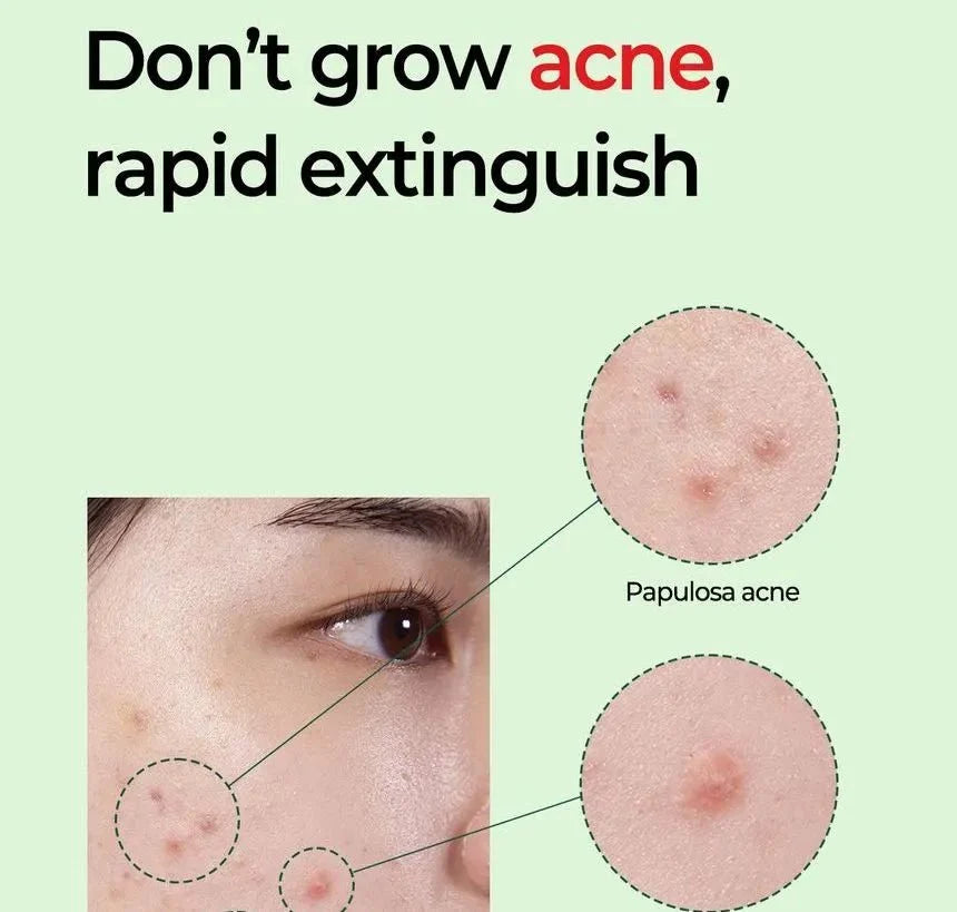 SOME BY MI Miracle AC Clear Spot Treatment 10g - photo 3