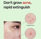SOME BY MI Miracle AC Clear Spot Treatment 10g - photo 3