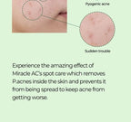 SOME BY MI Miracle AC Clear Spot Treatment 10g - photo 4