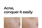 SOME BY MI Miracle AC Clear Spot Treatment 10g - photo 6