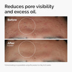 The Ordinary Niacinamide 10% + Zinc 1% Serum - photo 6